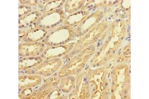 Immunohistochemistry of paraffin-embedded human kidney tissue using ABIN7171552 at dilution of 1:100 (TAS2R42 antibody  (AA 149-187))