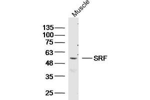 Mouse muscle lysates probed with SRF Polyclonal Antibody, unconjugated  at 1:300 overnight at 4°C followed by a conjugated secondary antibody at 1:10000 for 90 minutes at 37°C.