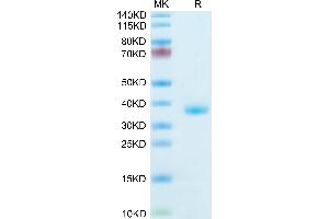 Mouse IGFBP2 on Tris-Bis PAGE under reduced condition. (IGFBP2 Protein (AA 35-305) (His tag))