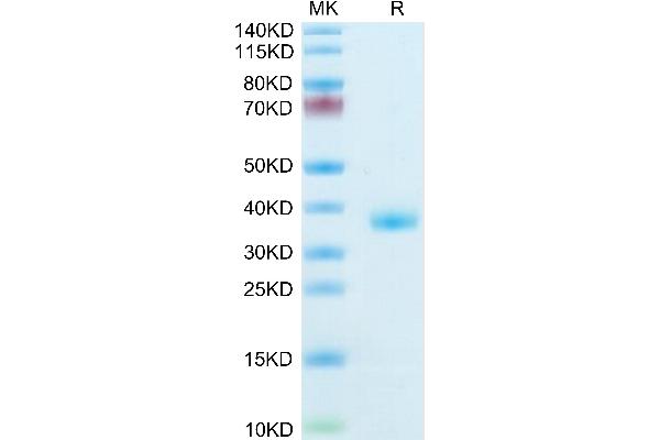 IGFBP2 Protein (AA 35-305) (His tag)