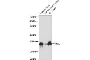 Western blot analysis of extracts of various cell lines, using MYL2 Rabbit mAb (ABIN7268761) at 1:1000 dilution. (MYL2 antibody)
