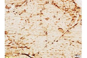 Formalin-fixed and paraffin embedded mouse liver tissue labeled with Anti-TIMP-3 Polyclonal Antibody , Unconjugated at 1:100, followed by conjugation to the secondary antibody and DAB staining (TIMP3 antibody  (AA 151-211))