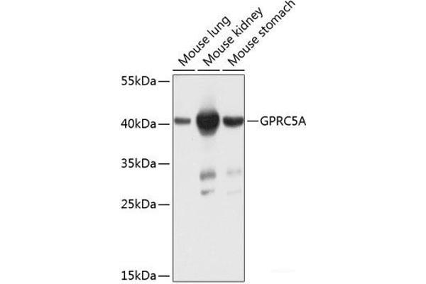 GPRC5A Antikörper