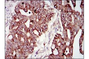 Immunohistochemistry (IHC) image for anti-Phosphoinositide 3 Kinase, p85 alpha (PI3K p85a) (AA 159-388) antibody (ABIN1844692) (PIK3R1 antibody  (AA 159-388))