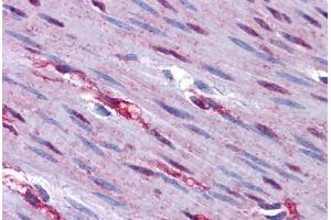 Human Colon, Muscularis Propria and Nerve: Formalin-Fixed, Paraffin-Embedded (FFPE) (FOXO3 antibody  (N-Term))