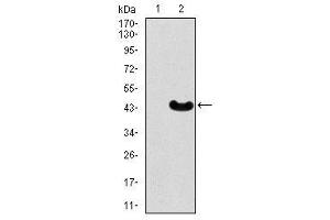 Image no. 2 for anti-Myocyte Enhancer Factor 2C (MEF2C) antibody (ABIN1490566)