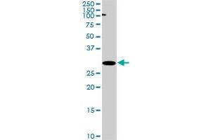 RPRD1A monoclonal antibody (M01), clone 1B8. (RPRD1A antibody  (AA 76-170))