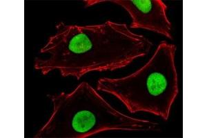 Fluorescent image of HeLa cells stained with SUMO-2 antibody at 1:25 dilution.