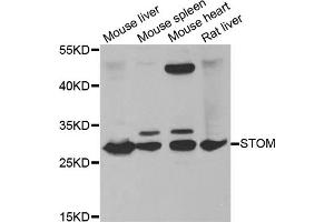 Western blot analysis of extracts of various cell lines, using STOM antibody (ABIN5973779) at 1/1000 dilution. (Stomatin antibody)