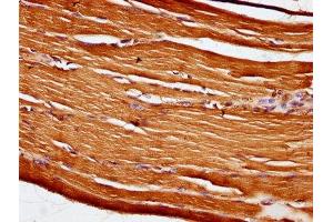 IHC image of ABIN7162115 diluted at 1:100 and staining in paraffin-embedded human skeletal muscle tissue performed on a Leica BondTM system.