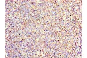 Immunohistochemistry of paraffin-embedded human tonsil tissue using ABIN7156730 at dilution of 1:100 (IL1A antibody  (AA 1-152))
