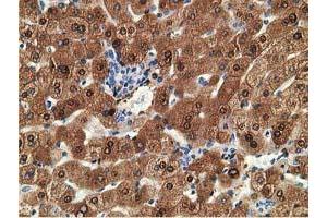 Immunohistochemical staining of paraffin-embedded Human liver tissue using anti-ADH1B mouse monoclonal antibody.