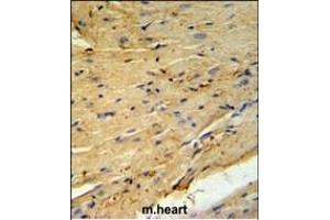 PLB-T17 Antibody (ABIN653840 and ABIN2843104) IHC analysis in formalin fixed and paraffin embedded mouse heart tissue followed by peroxidase conjugation of the secondary antibody and DAB staining. (PLB-T17 (AA 1-30) antibody)