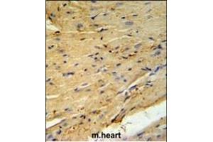 PLB-T17 Antibody (ABIN653840 and ABIN2843104) IHC analysis in formalin fixed and paraffin embedded mouse heart tissue followed by peroxidase conjugation of the secondary antibody and DAB staining. (PLB-T17 (AA 1-30) antibody)
