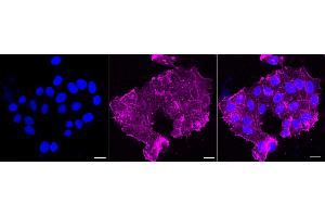 anti-Actin, alpha 1, Skeletal Muscle (ACTA1) antibody