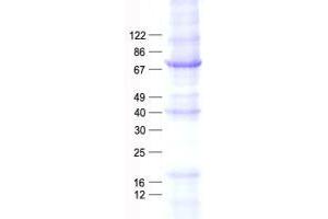 Western Blotting (WB) image for Nuclear Receptor Subfamily 4, Group A, Member 3 (NR4A3) protein (His tag) (ABIN2733397)