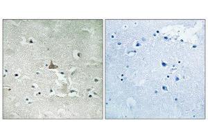Immunohistochemistry (IHC) image for anti-Neurotrophic Tyrosine Kinase, Receptor, Type 2 (NTRK2) (pTyr706), (pTyr707) antibody (ABIN1847660) (TRKB antibody  (pTyr706, pTyr707))