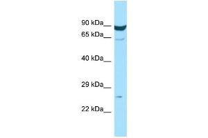 WB Suggested Anti-MS4A7 Antibody Titration: 1.