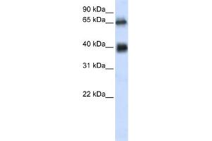 WB Suggested Anti-C6orf113 Antibody Titration:  0. (ZUFSP antibody  (Middle Region))