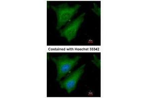 ICC/IF Image Immunofluorescence analysis of paraformaldehyde-fixed HeLa, using SOCS4, antibody at 1:200 dilution. (SOCS4 antibody  (C-Term))