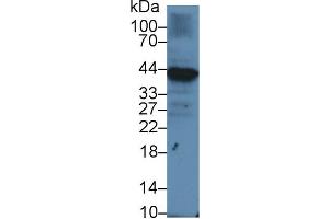 Western blot analysis of Human Raji cell lysate, using Human Iga Antibody (1 µg/ml) and HRP-conjugated Goat Anti-Rabbit antibody (