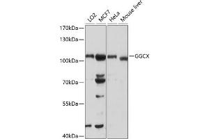 Western blot analysis of extracts of various cell lines, using GGCX antibody (ABIN6129015, ABIN6141069, ABIN6141070 and ABIN6218918) at 1:1000 dilution.