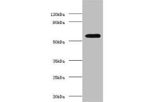 Western blot All lanes: OXCT1 antibody at 2 μg/mL + Hela whole cell lysate Secondary Goat polyclonal to rabbit IgG at 1/15000 dilution Predicted band size: 57, 14 kDa Observed band size: 57 kDa (OXCT1 antibody  (AA 40-520))