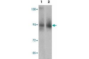 Western blot analysis of ZBTB5 in mouse brain tissue lysate with ZBTB5 polyclonal antibody  at (1) 1 and (2) 2 ug/mL. (ZBTB5 antibody  (C-Term))