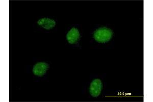Immunofluorescence of purified MaxPab antibody to HGD on HeLa cell. (HGD antibody  (AA 1-445))