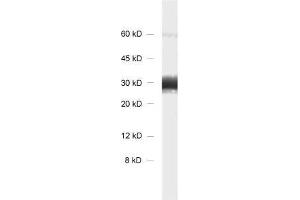 dilution: 1 : 1000, sample: rat brain homogenate. (Synaptogyrin 1 antibody)