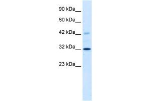 WB Suggested Anti-VDAC1 Antibody Titration:  1. (VDAC1 antibody  (C-Term))
