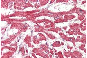 Heart, Human: Formalin-Fixed, Paraffin-Embedded (FFPE) (FABP7 antibody  (AA 101-111))