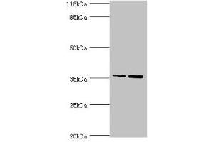Western blot All lanes: CFHR2 antibody at 2 μg/mL Lane 1: Hela whole cell lysate Lane 2: 293T whole cell lysate Secondary Goat polyclonal to rabbit IgG at 1/10000 dilution Predicted band size: 31, 28 kDa Observed band size: 36 kDa (CFHR2 antibody  (AA 20-269))