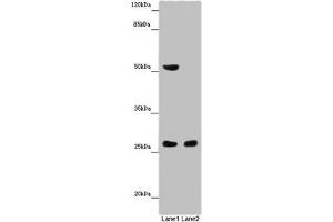 Western blot All lanes: CHTOP antibody at 14 μg/mL Lane 1: Mouse heart tissue Lane 2: Mouse kidney tissue Secondary Goat polyclonal to rabbit IgG at 1/10000 dilution Predicted band size: 27, 22 kDa Observed band size: 27, 52 kDa