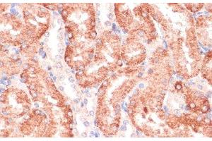 Immunohistochemistry of paraffin-embedded Rat kidney using RPIA Polyclonal Antibody at dilution of 1:100 (40x lens).