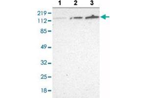 Western blot analysis of Lane 1: RT-4 cell lysate, Lane 2: U-251 MG sp cell lysate, Lane 3: A-431 cell lysate with WDHD1 polyclonal antibody at 1:250 - 1:500 dilution. (WDHD1 antibody  (AA 231-345))