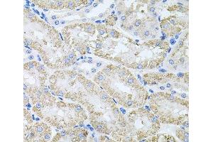 Immunohistochemistry of paraffin-embedded Mouse kidney using TARS Polyclonal Antibody at dilution of 1:100 (40x lens).