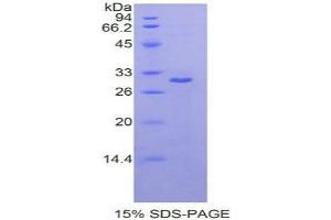 SDS-PAGE analysis of Rat MAPK8 Protein. (JNK Protein)