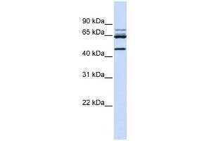 DDX47 antibody used at 1 ug/ml to detect target protein. (DDX47 antibody)