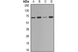 Western blot analysis of Deltex-2 expression in Jurkat (A), HepG2 (B), mouse testis (C), mouse spleen (D) whole cell lysates.