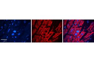 Rabbit Anti-DHCR24 Antibody   Formalin Fixed Paraffin Embedded Tissue: Human heart Tissue Observed Staining: Cytoplasmic Primary Antibody Concentration: 1:100 Other Working Concentrations: 1:600 Secondary Antibody: Donkey anti-Rabbit-Cy3 Secondary Antibody Concentration: 1:200 Magnification: 20X Exposure Time: 0. (Seladin 1 antibody  (Middle Region))