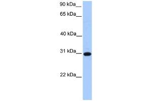 WB Suggested Anti-ETFB Antibody Titration: 0. (ETFB antibody  (C-Term))