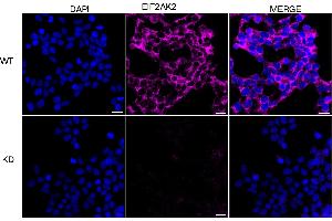 anti-Eukaryotic Translation Initiation Factor 2-alpha Kinase 2 (EIF2AK2) antibody