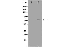Western blot analysis of Hela whole cell lysates, using TRAF2  Antibody. (TRAF2 antibody  (C-Term))