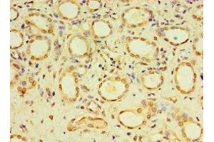 Immunohistochemistry of paraffin-embedded human kidney tissue using ABIN7149492 at dilution of 1:100 (DACT3 antibody  (AA 1-160))