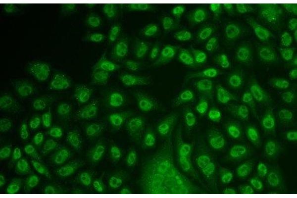 TFPT antibody