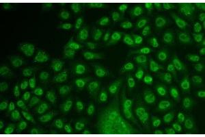 Immunofluorescence analysis of U2OS cells using TFPT Polyclonal Antibody (TFPT antibody)