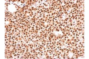 Immunohistochemistry (IHC) image for anti-Forkhead Box O3 (FOXO3) (C-Term) antibody (ABIN2854686)