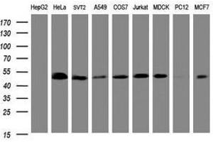 Image no. 2 for anti-SERPINE1 mRNA Binding Protein 1 (SERBP1) (AA 1-262) antibody (ABIN1490674) (SERBP1 antibody  (AA 1-262))
