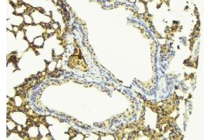 ABIN6276798 at 1/100 staining Mouse lung tissue by IHC-P. (PDE4D antibody  (C-Term))